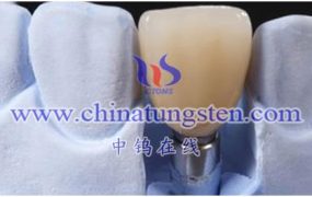 What Is High-Density Tungsten Alloy Medical Prosthesis?